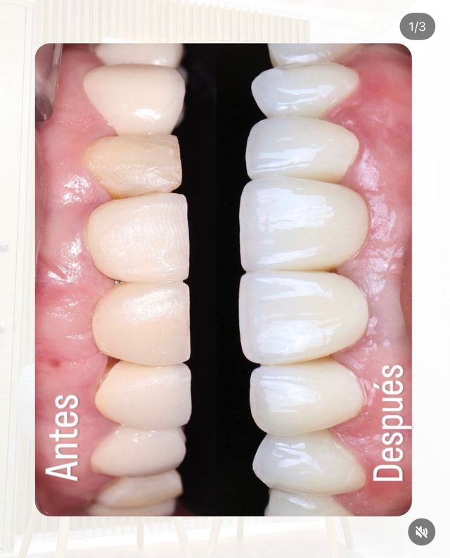 Acercar imagen: Stacy Casilimas Salud y Estética Dental