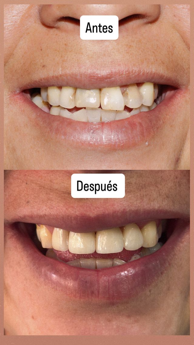 Acercar imagen: Clínica Odontológica Cenit Sucursal Hochstetter