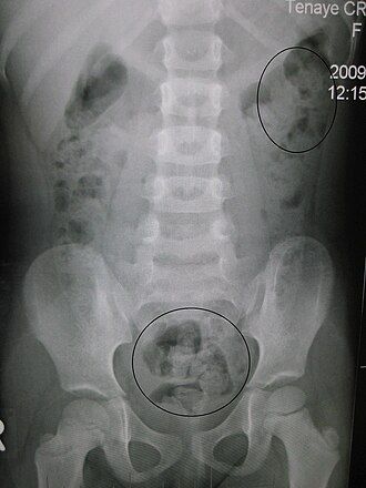 Acercar imagen: Consulta online pediatrica