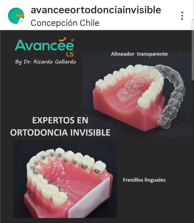 Acercar imagen: Avancée