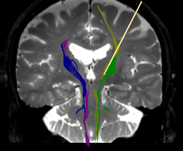 Ampliar imagem: Consultorio em neurocirurgia funcional  - Neumodulação Geral