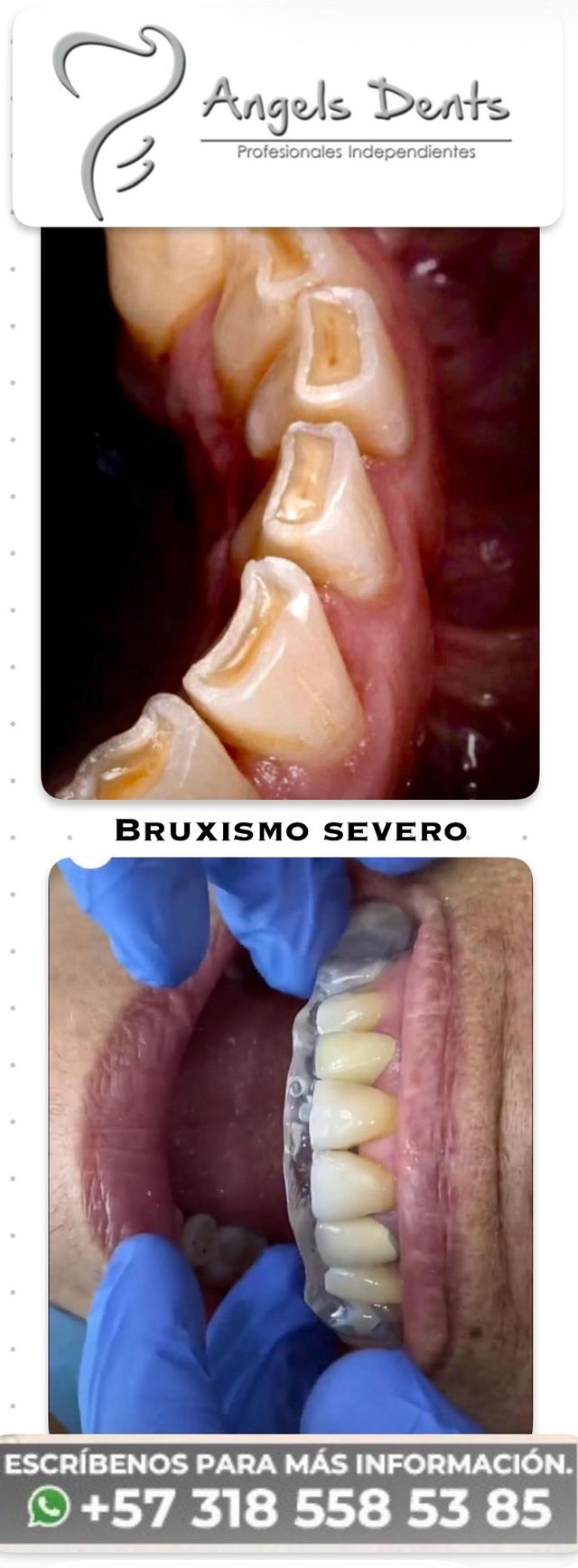 Acercar imagen: ORTODONCIA CORRECTIVA, ORTOPEDIA MAXILOFACIAL