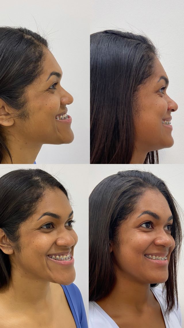 Ampliar imagem: Dra Letícia Girotti - Cirurgia Bucomaxilofacil & Estética facial 