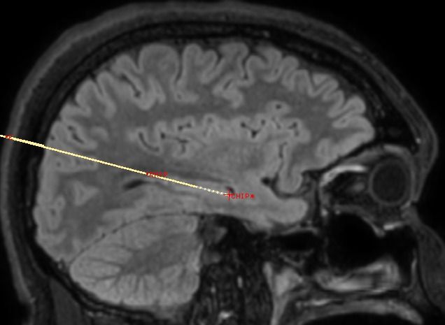 Ampliar imagem: Consultorio em Neuromodulação