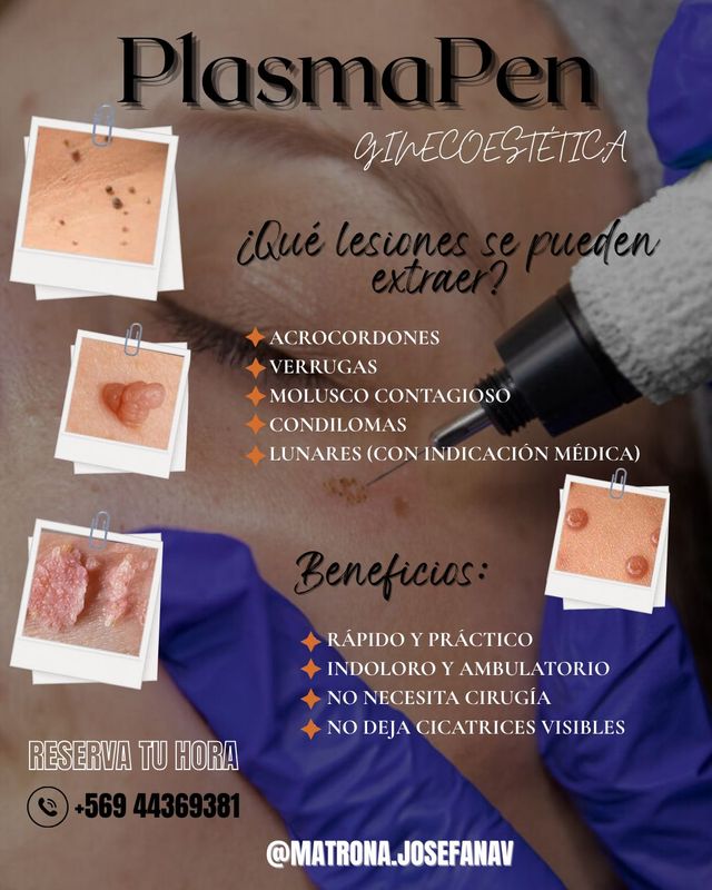 Acercar imagen: Consulta presencial Curicó