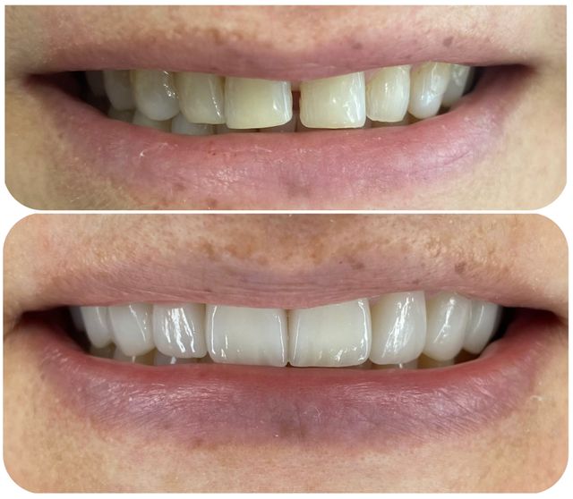 Acercar imagen: Consulta Privada