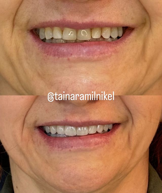 Ampliar imagem: Derane Odontologia e Harmonizaçao Facial