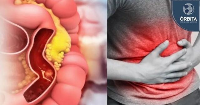 Acercar imagen: Consulta online consultorio de enfermedades digestivas y ano rectales.