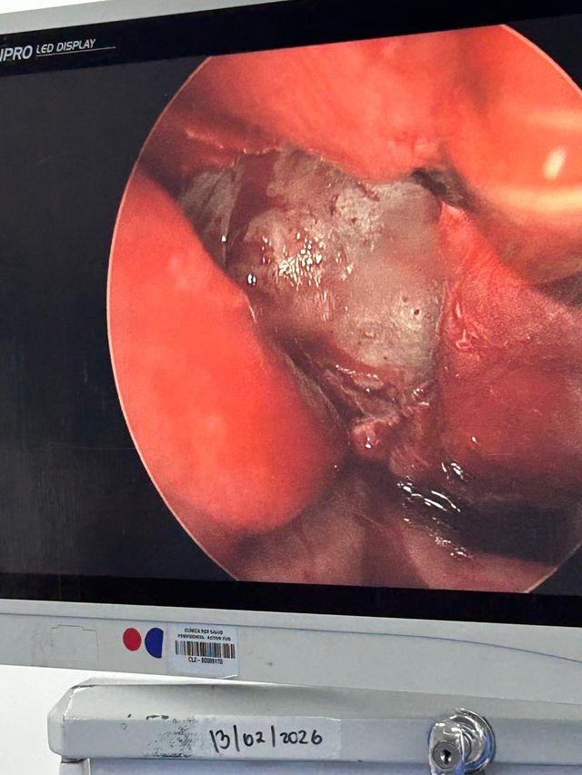 Acercar imagen: CONSULTA PARTICULAR