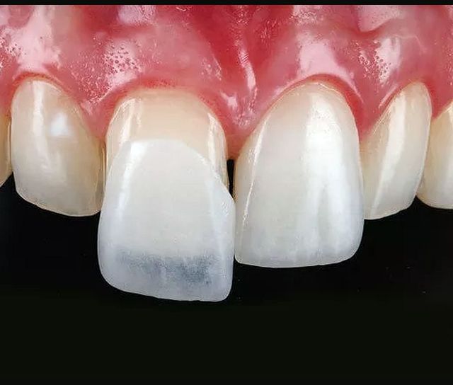 Acercar imagen: KrosDent centro de implantes dentales