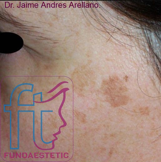 Acercar imagen: FUNDAESTETIC