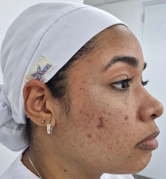 Acercar imagen: Dra Jannell Obregón - Dermatología Tu Piel