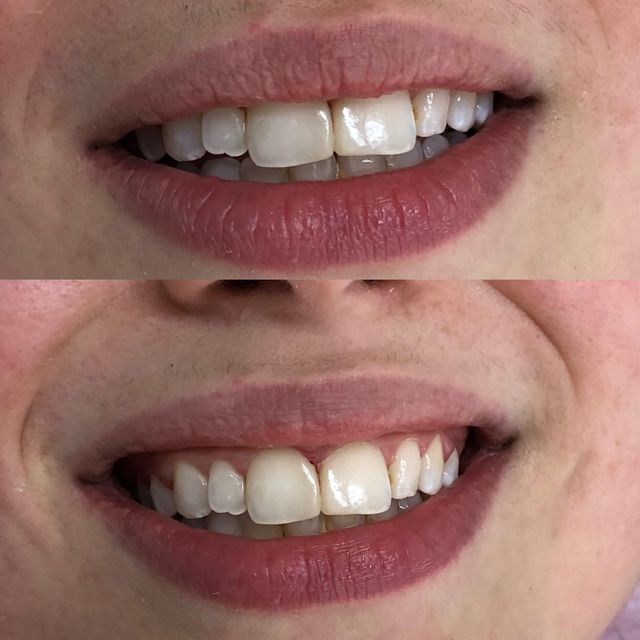 Ampliar imagem: Dra Ivanilda - Dentista Vila Mariana