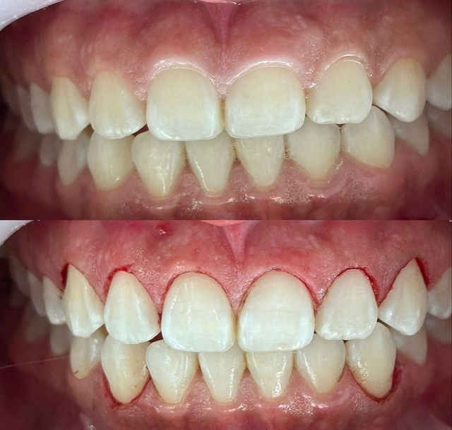 Acercar imagen: Dentabell