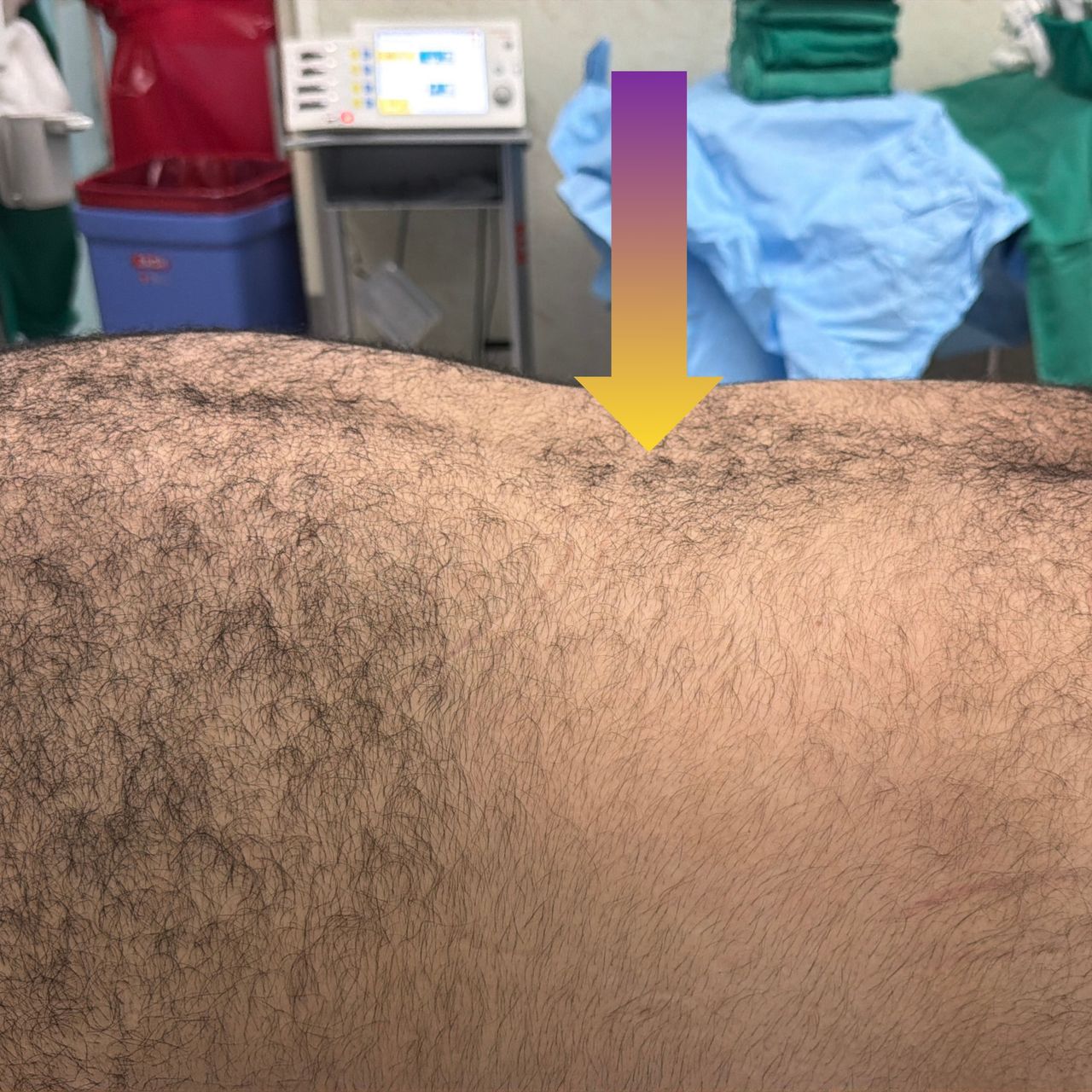 David Tafur Muñoz-2380