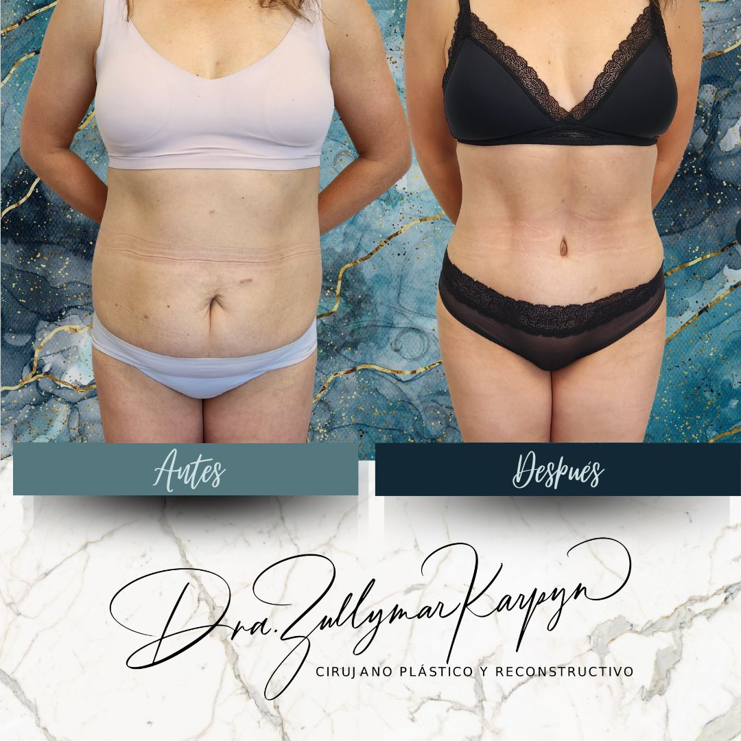 Zullymar Karpyn Brito-0