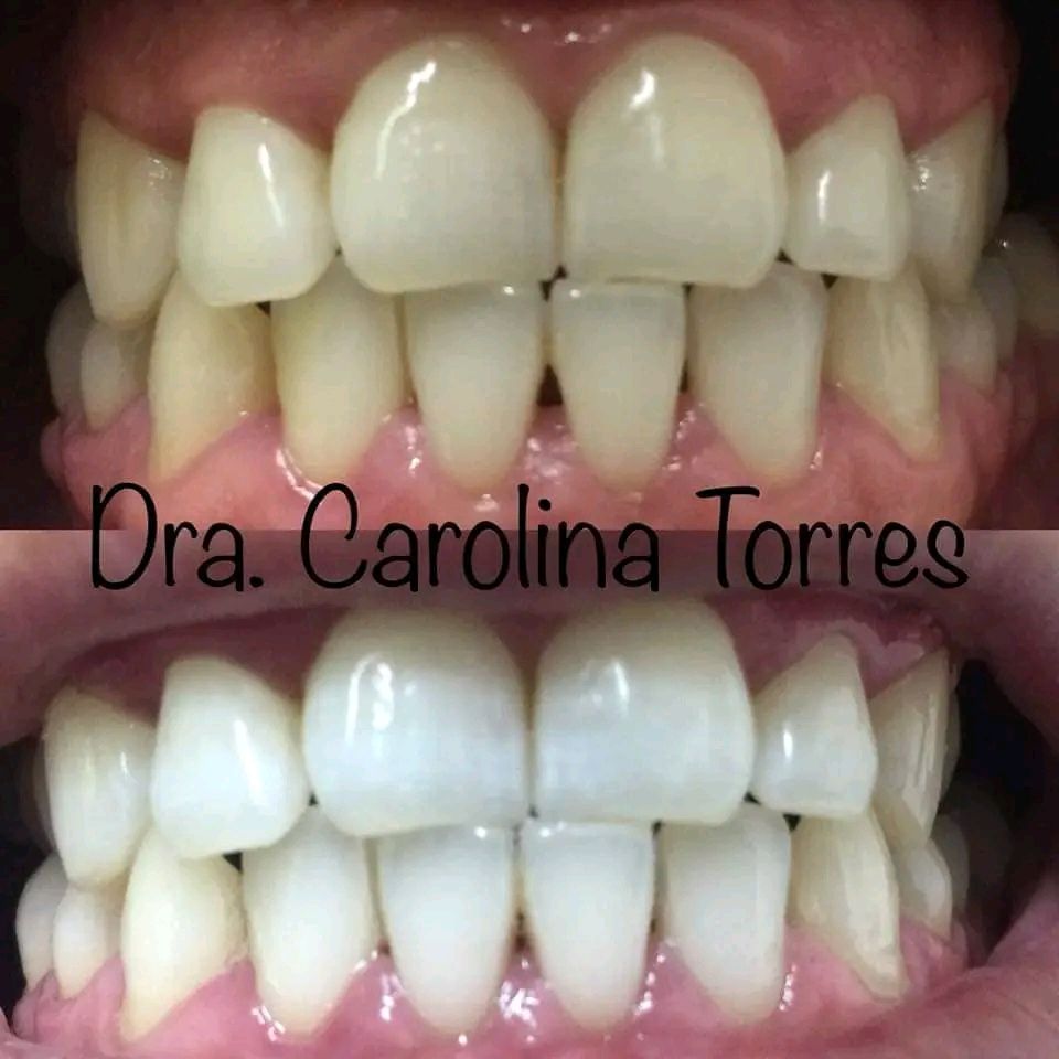 Carolina Alejandra Torres Acuña-4