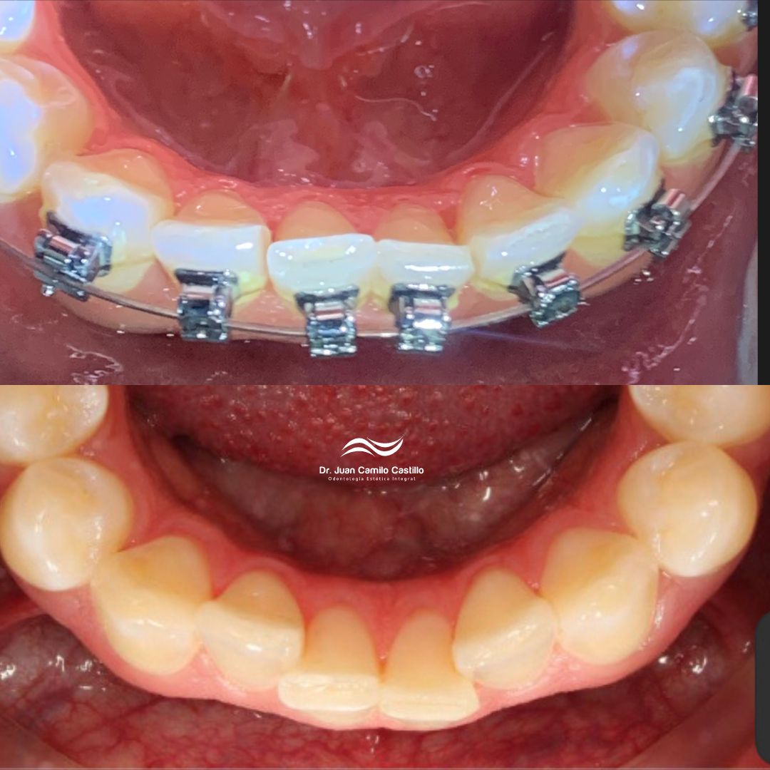 Juan Camilo Castillo-7