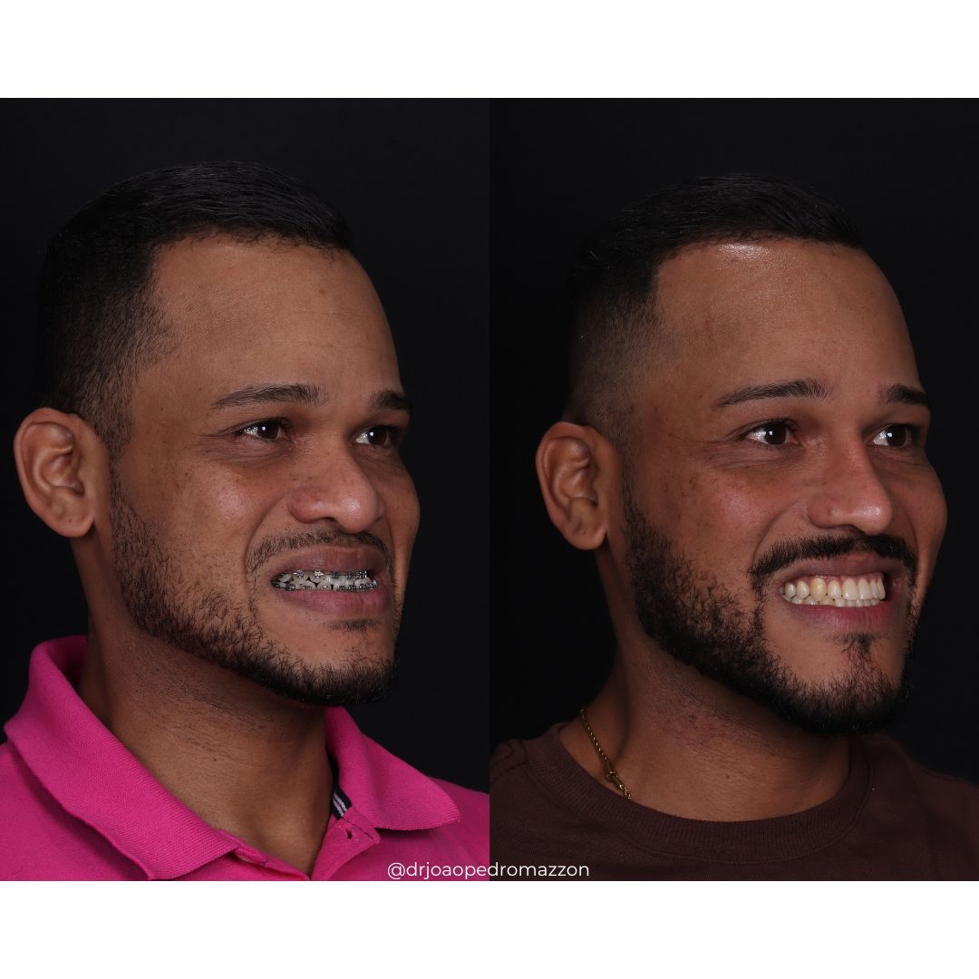 João Pedro Paulino Mazzon-57