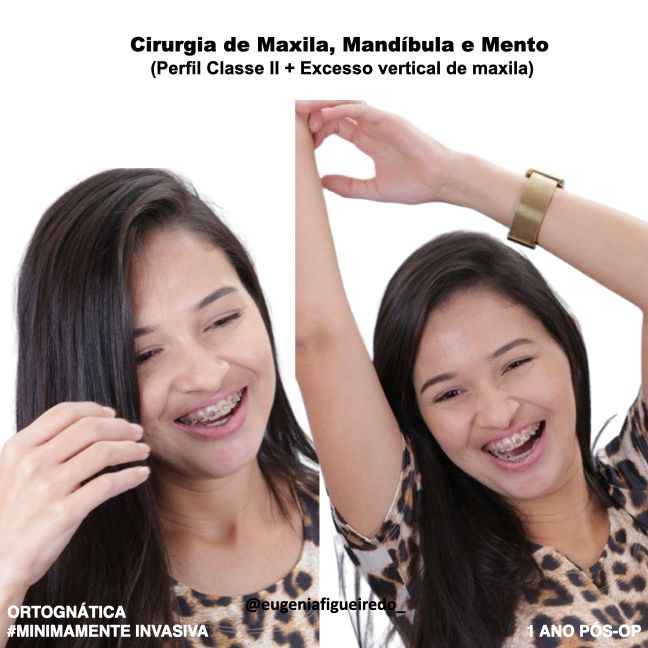Eugênia Figueiredo-37