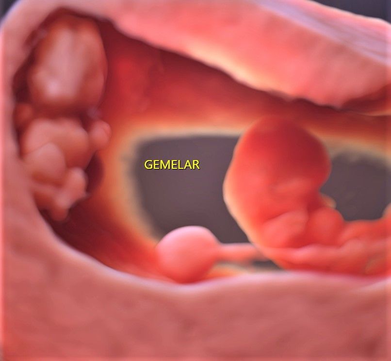 Charles Schwantz De Lima-33