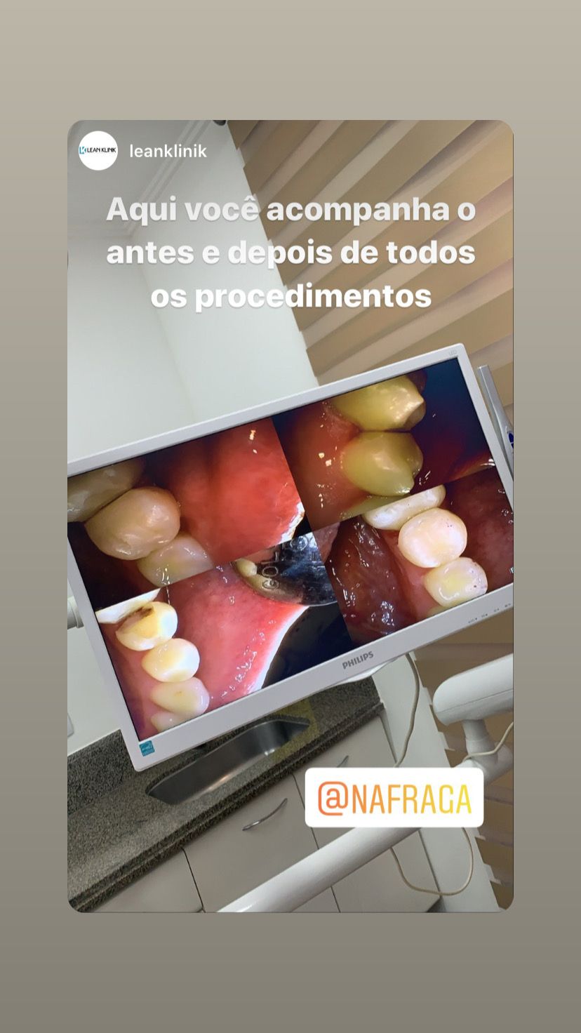 Nayara Fraga De Miranda-22