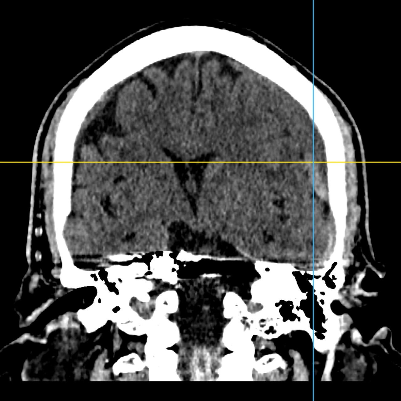 David Tafur Muñoz-2477