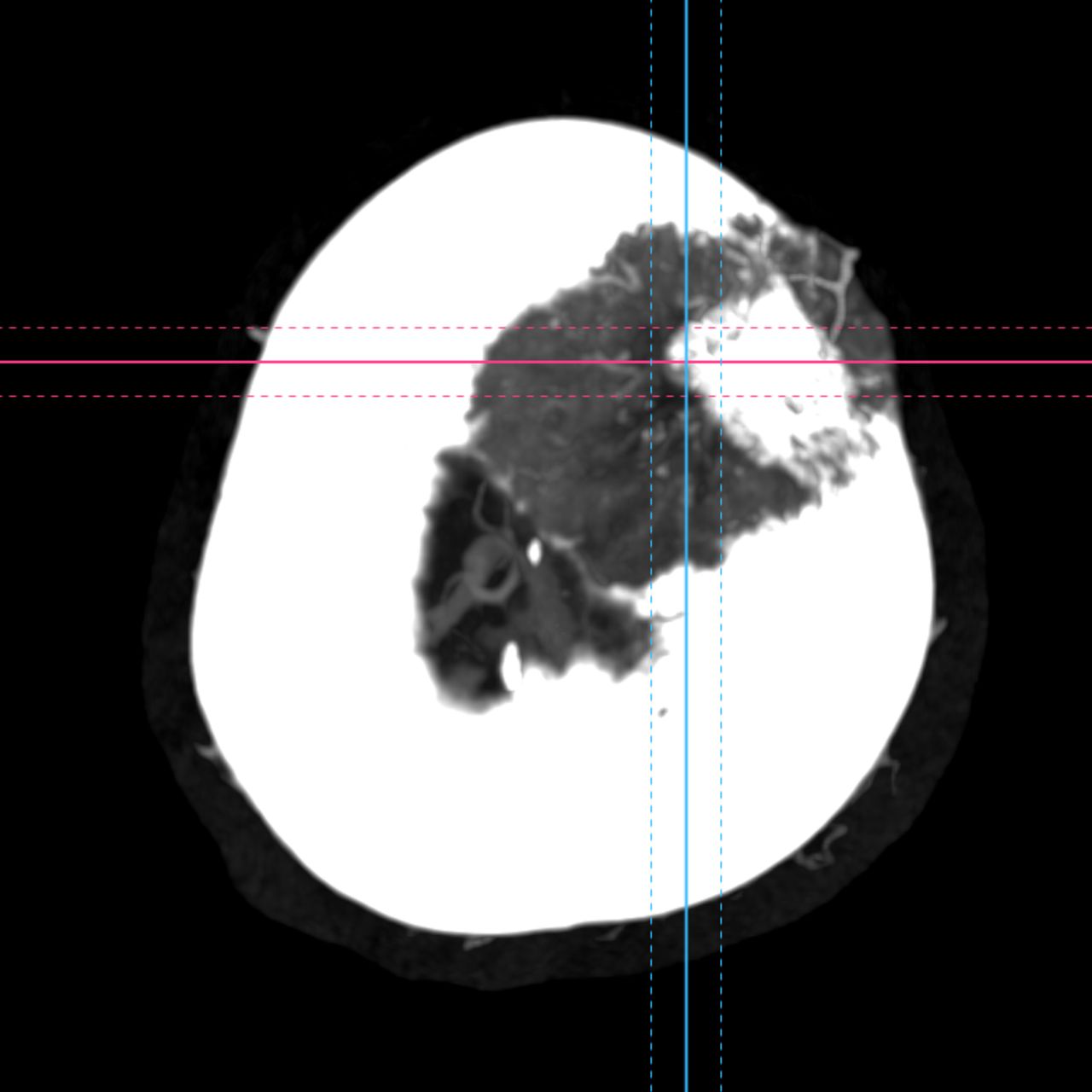 David Tafur Muñoz-2266