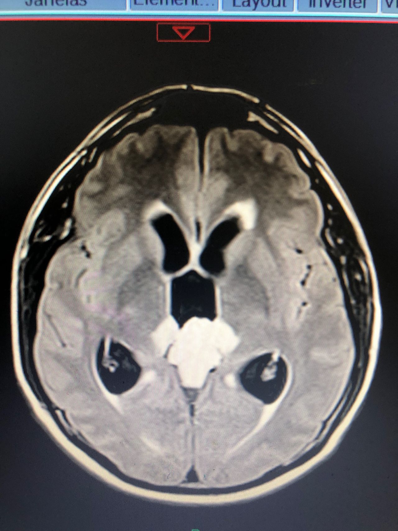 José Lopes Sousa Filho-30