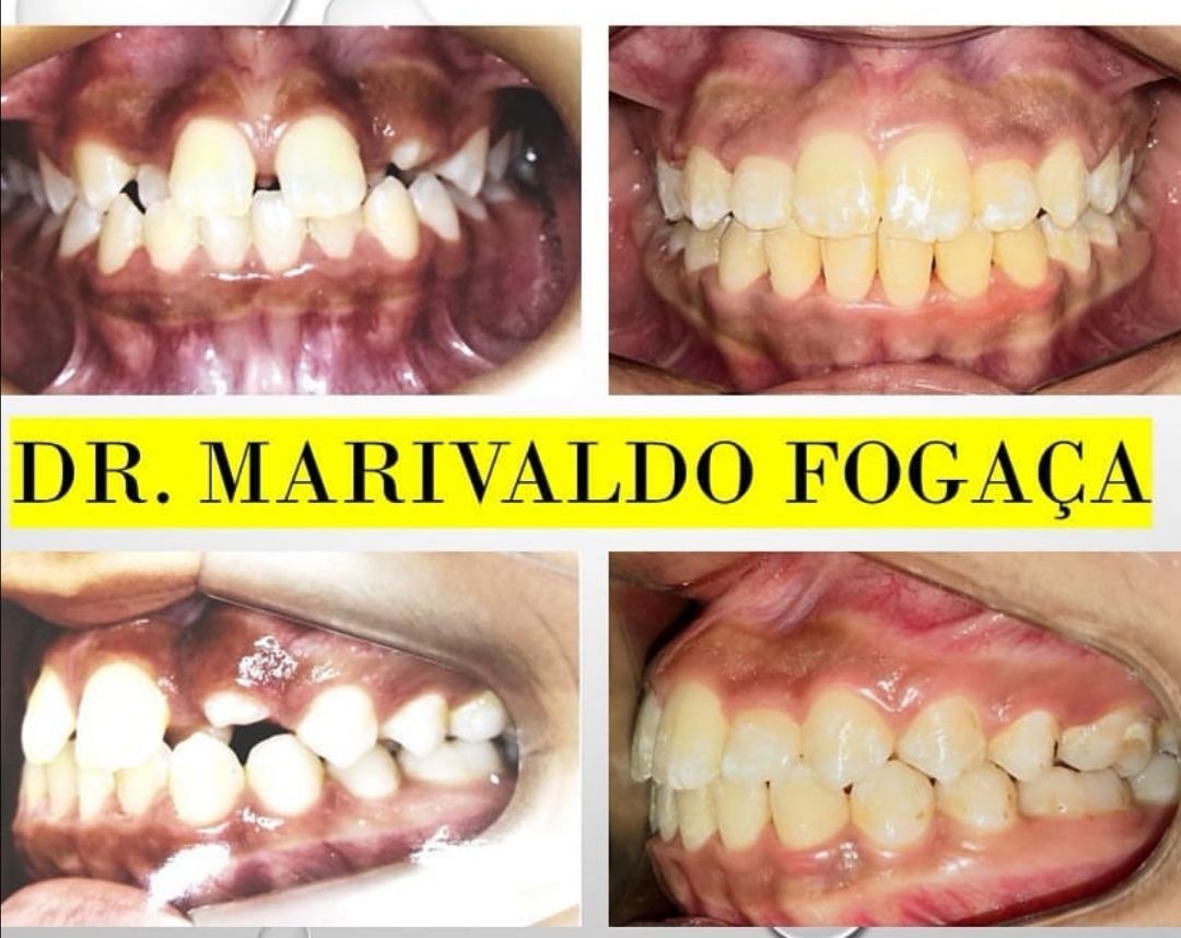 Marivaldo Fogaça-12