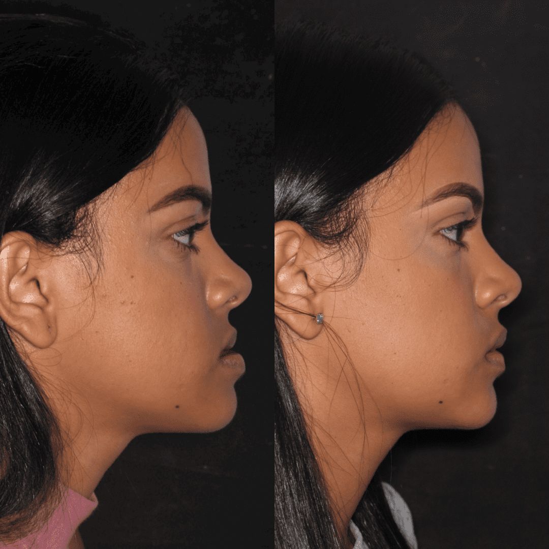 Raffael Maron Vieira De Noronha-3