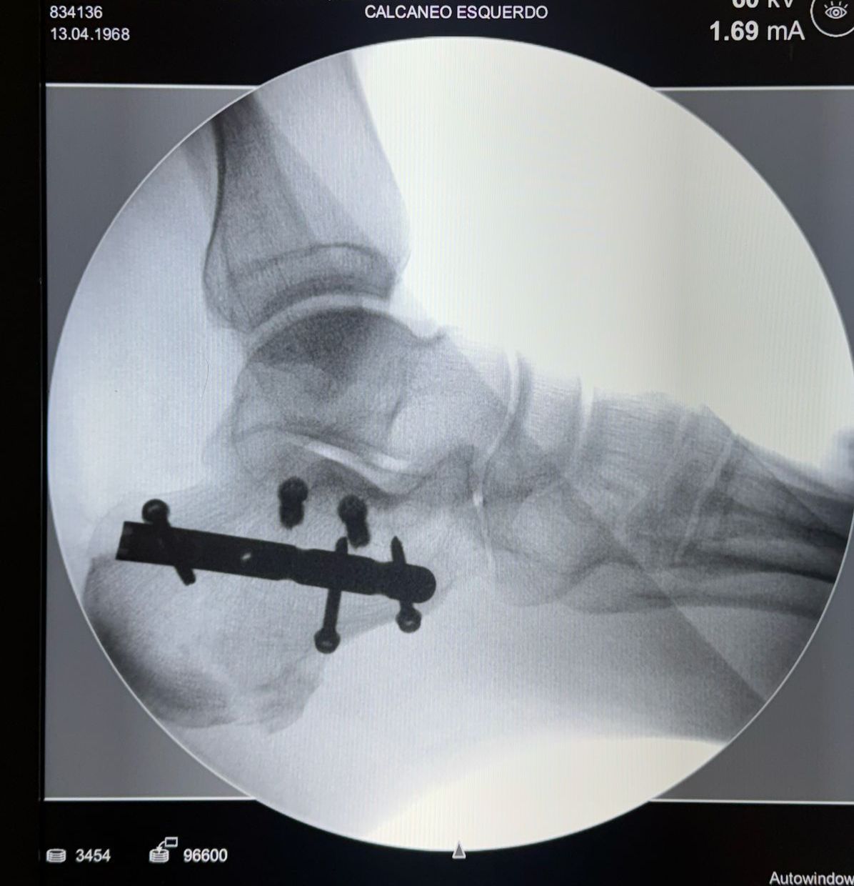 Romeu Maggesissi Travezani-6