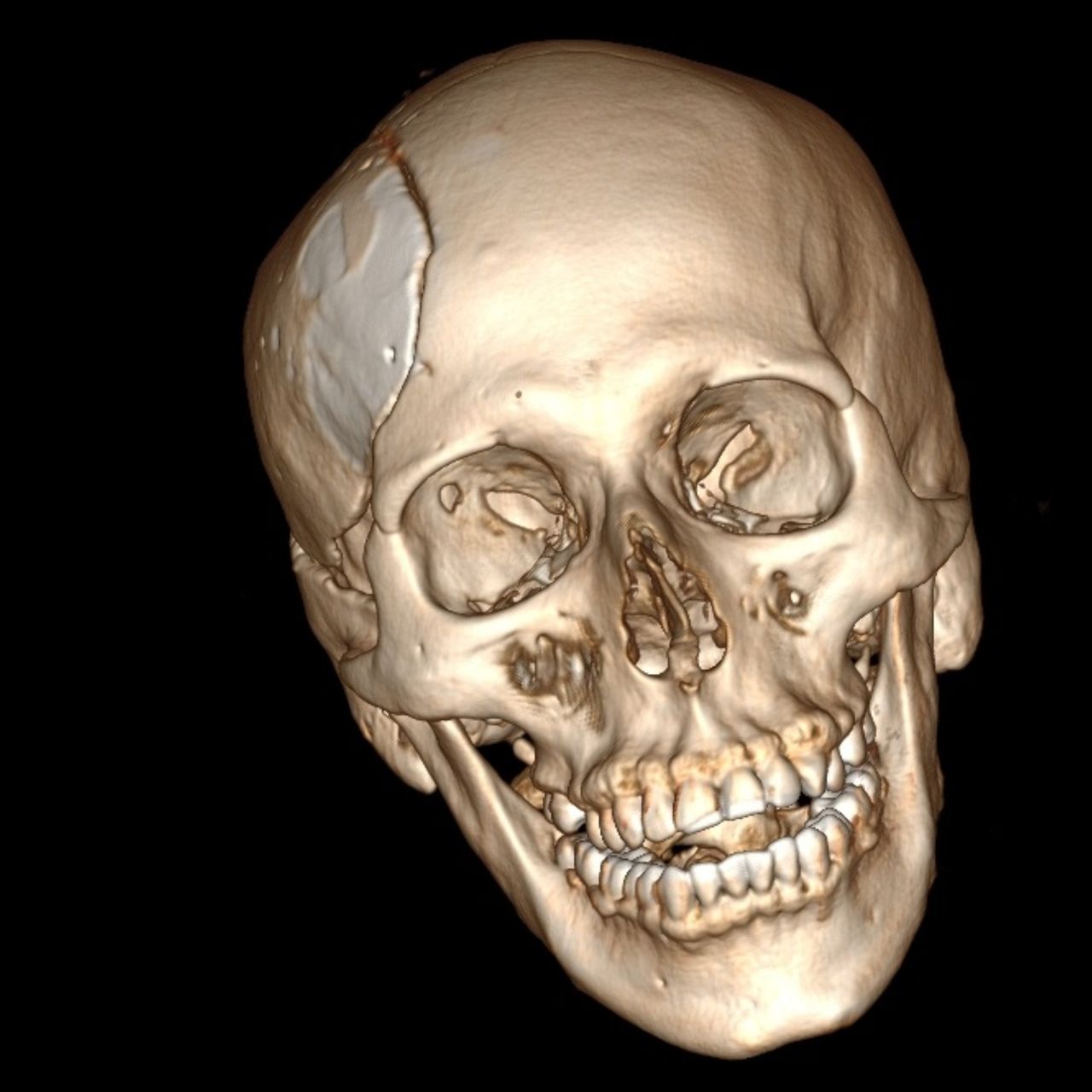 David Tafur Muñoz-1273