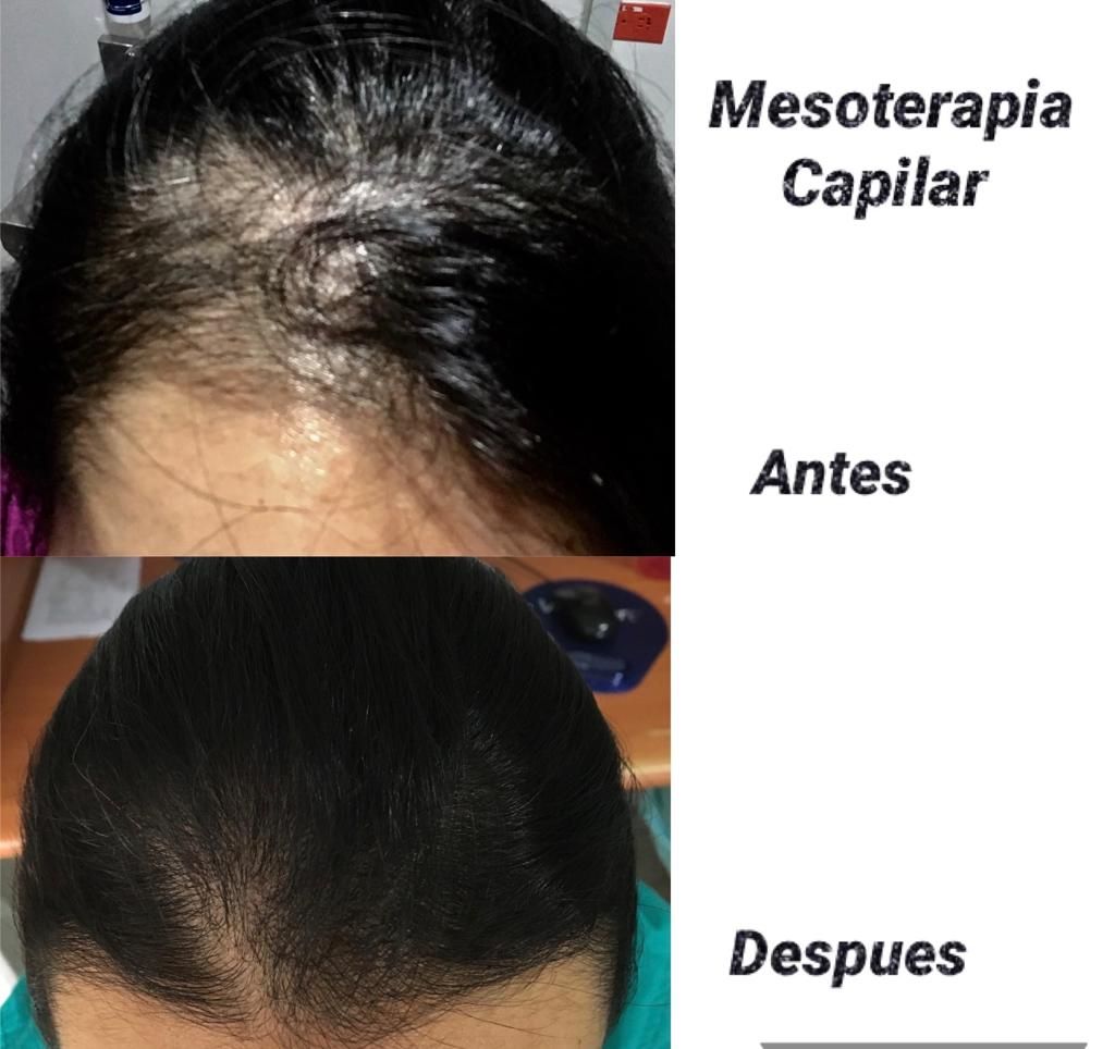 Maria Gisela Angel Losada-77