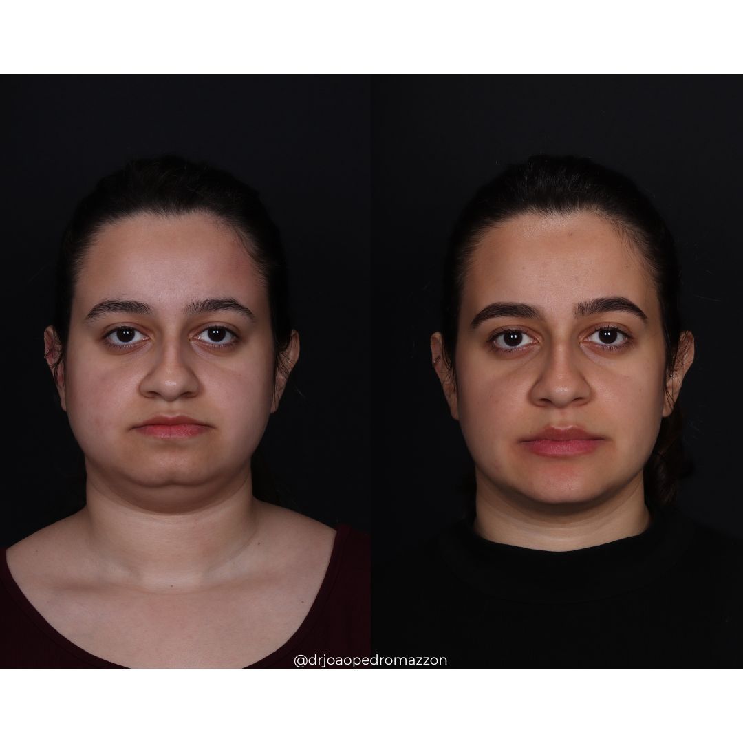 João Pedro Paulino Mazzon-61