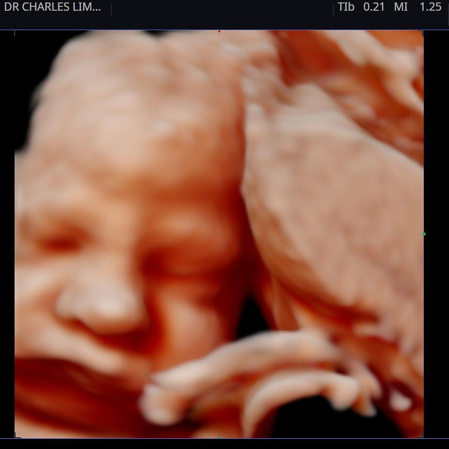 Charles Schwantz De Lima-28