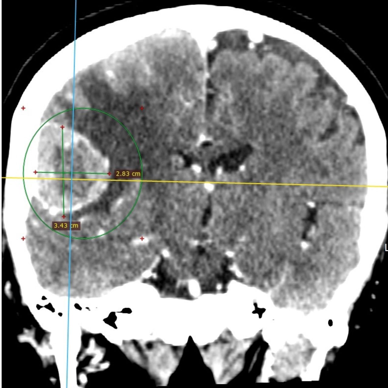 David Tafur Muñoz-1372