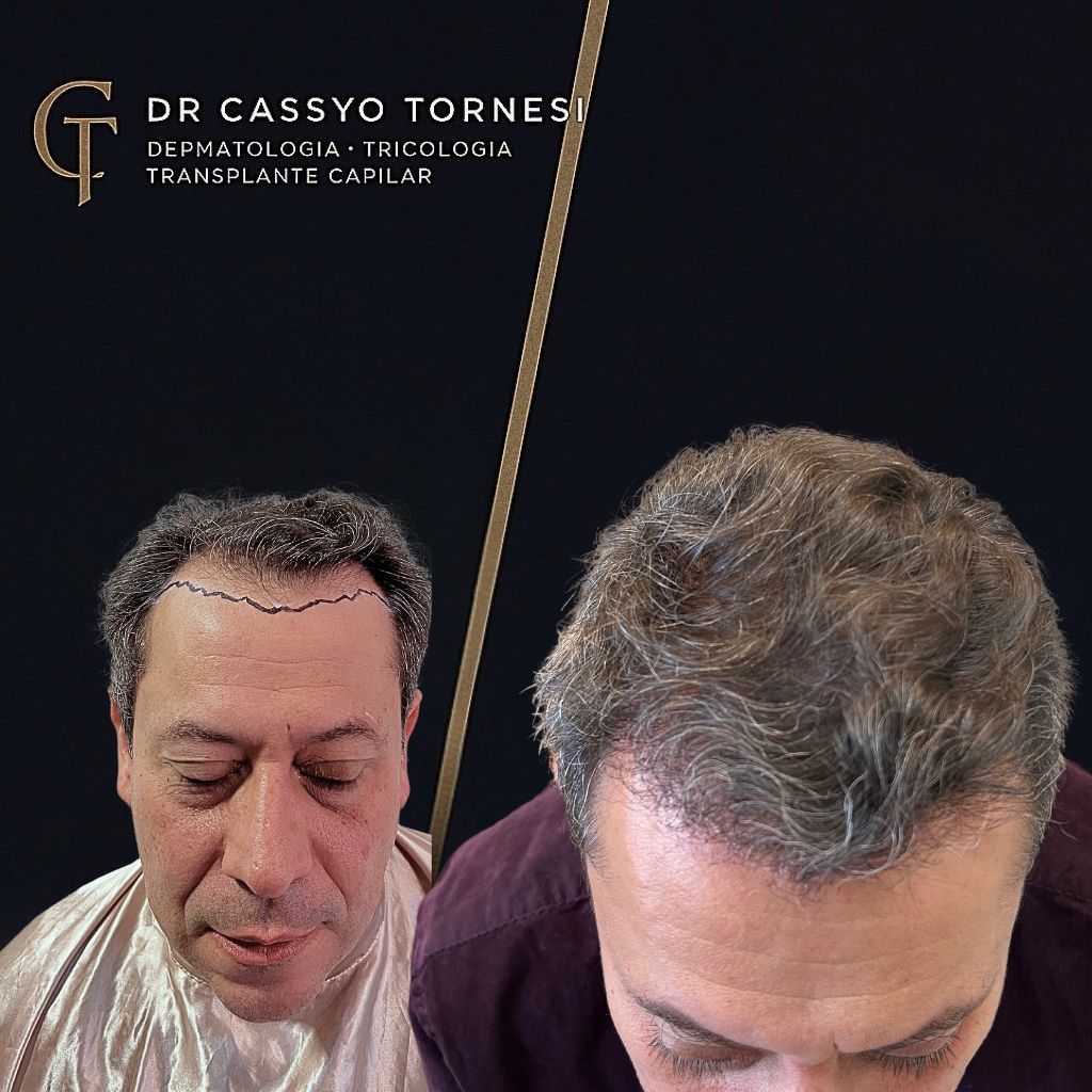 Cassyo Tornesi-12