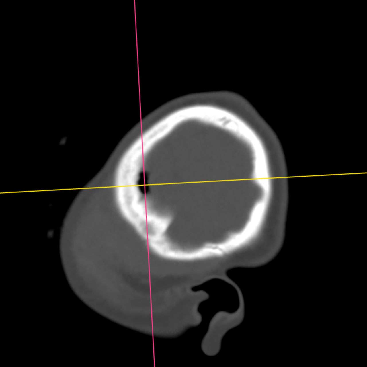 David Tafur Muñoz-2291