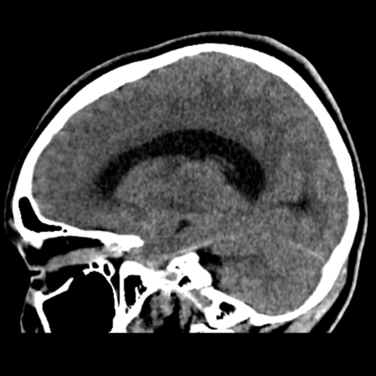 David Tafur Muñoz-1822