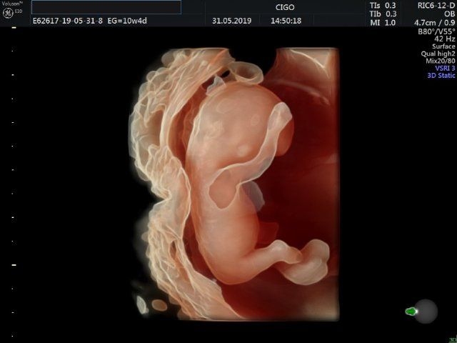 Raul Javier Banderas Pumarino-17