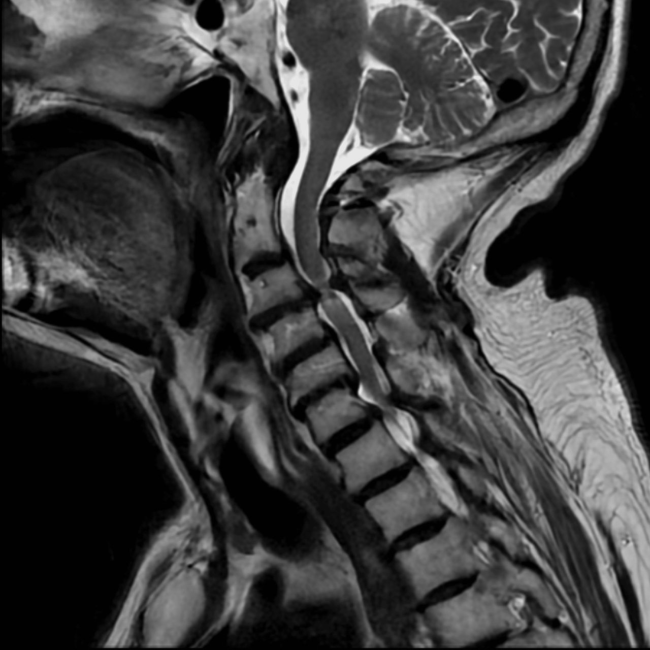 David Tafur Muñoz-2345