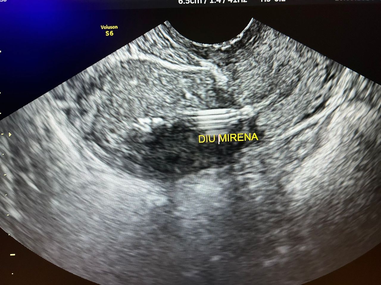 Gilbran Simões Da Silva-2
