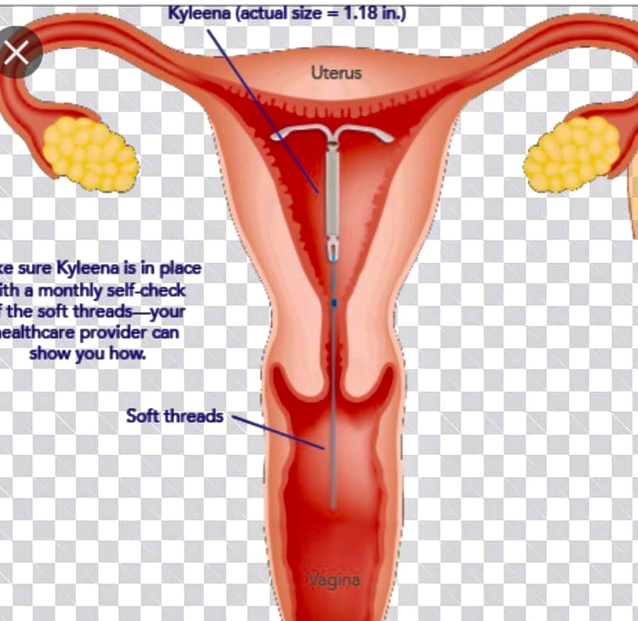 Marisabel Boere De Moraes Reis-3