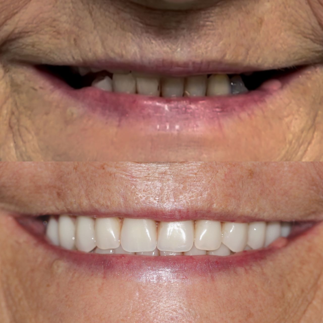 Caroline Benedeti-40