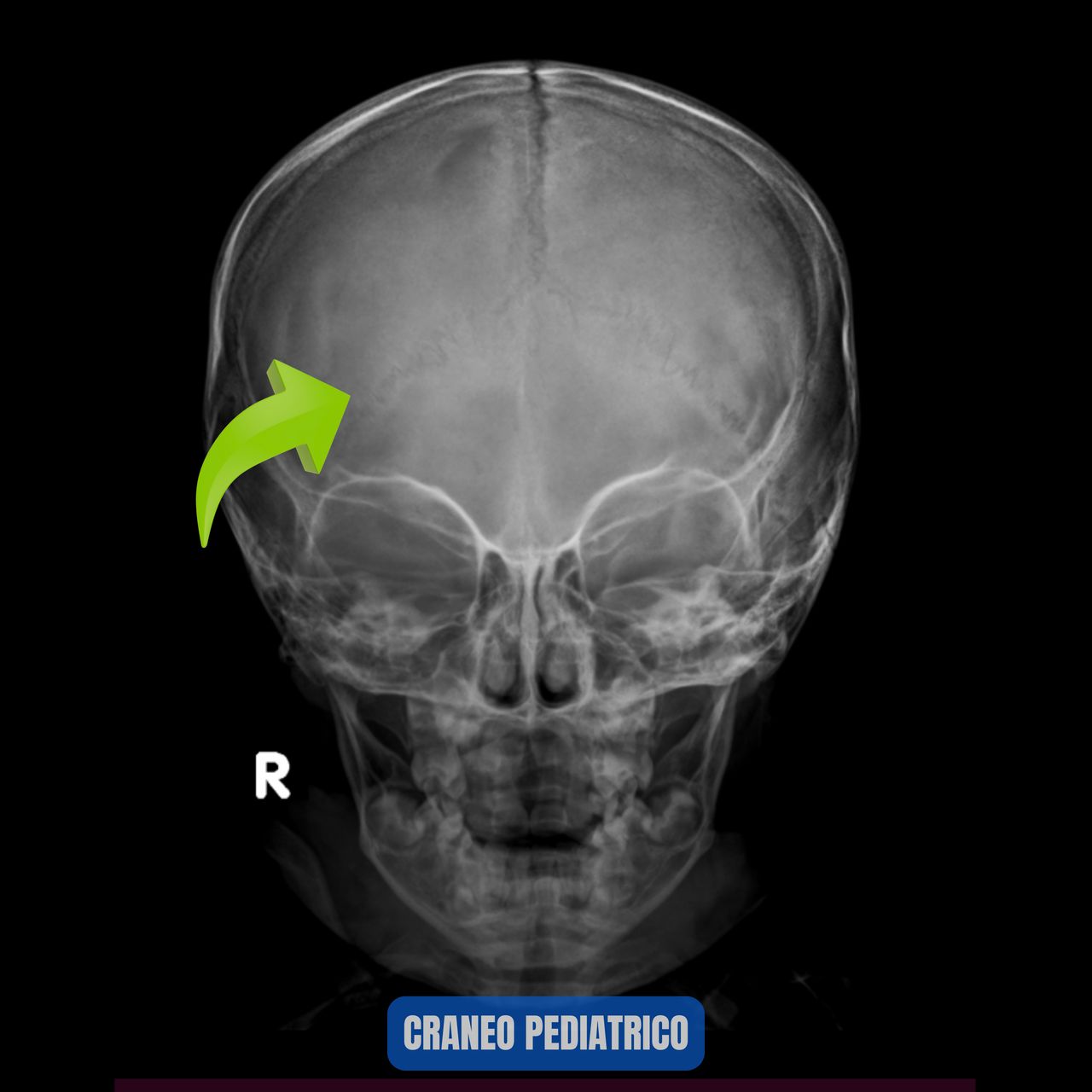David Tafur Muñoz-1031