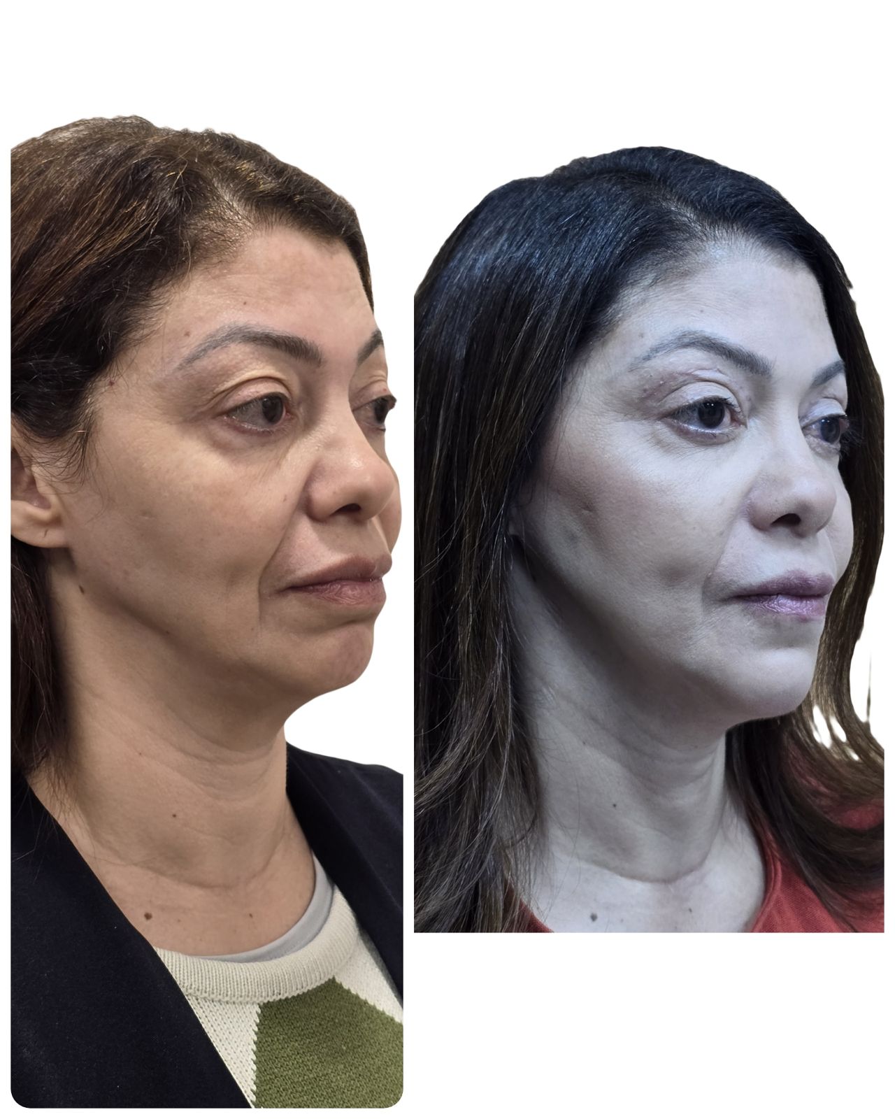 Pedro Henrique Faria Denofrio-3