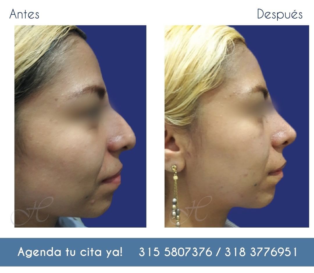 Jorge A Holguin Ruiz-51