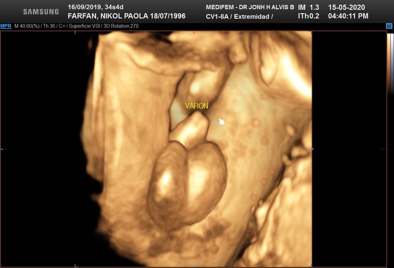 Jonh Harold Alvis Botello-18