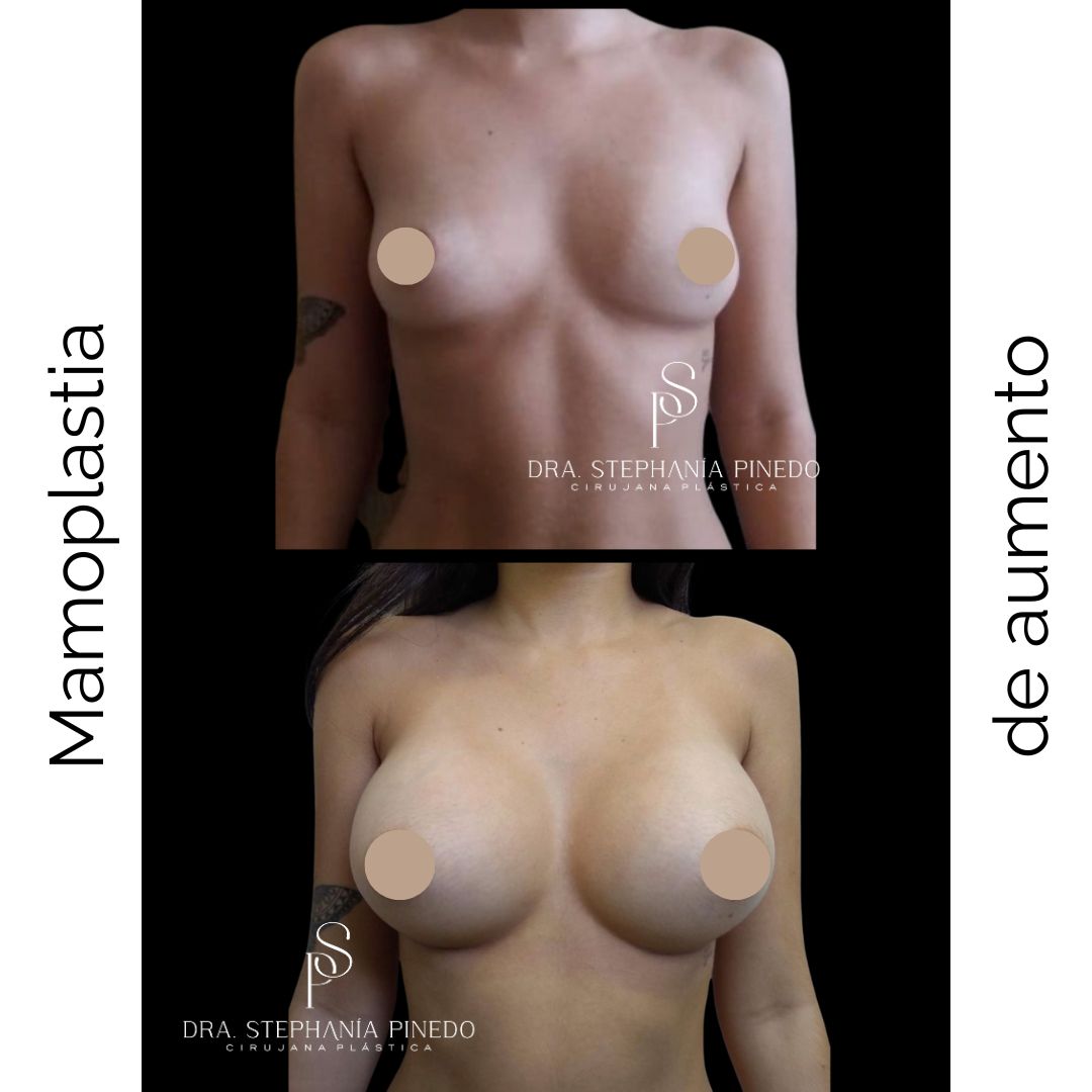 Stephanía Pinedo García-27